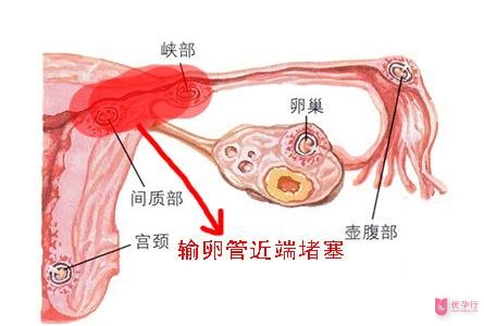 下载 (1).jpg